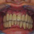 2013 Abschlussbefund Funktionstherapeutische Rekonstruktion