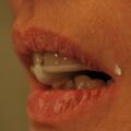 Adjustierter Aufbissbehelf